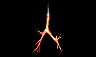 CFD respiratory tract